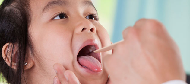 About Mumps | Mumps | CDC About Mumps | Mumps | CDC