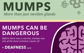 Mumps infographic: more than just swollen glands