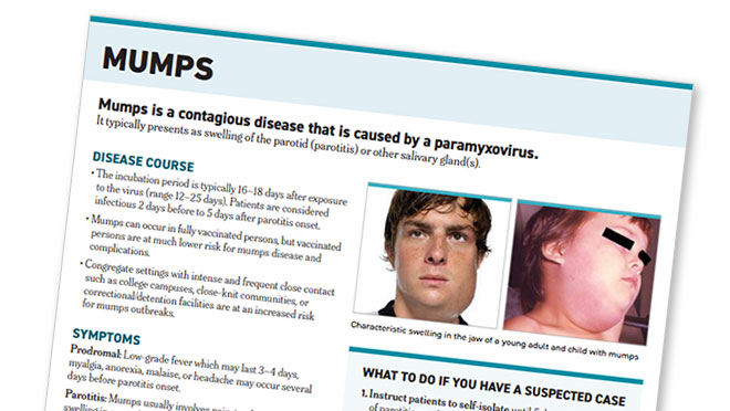 Mumps Clinical Diagnosis Fact Sheet | Mumps | CDC