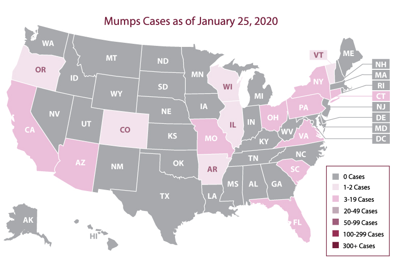 Mumps Cases map, May 24, 2020: NY, CT, OH, VA, SC, FL MO, PA, TX, AZ and CA have the highest numbers of reported cases.