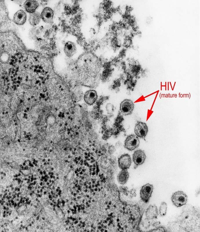hiv-micrograph