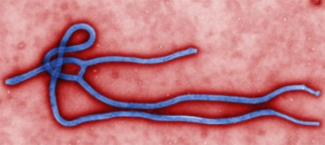 Ebola microscopic image