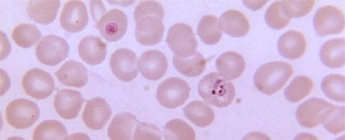 Photo of malaria cells under a microscope