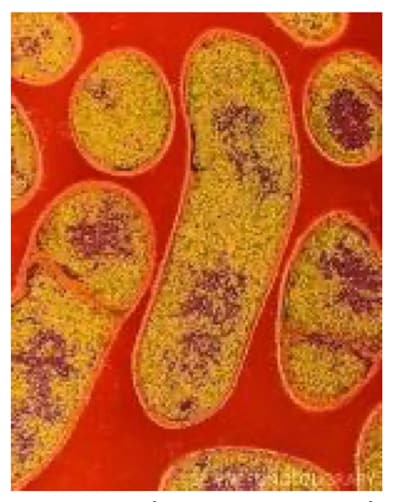 Colored transmission electron micrograph of the Gram-positive anaerobic bacteria Clostridium botulinum. 
