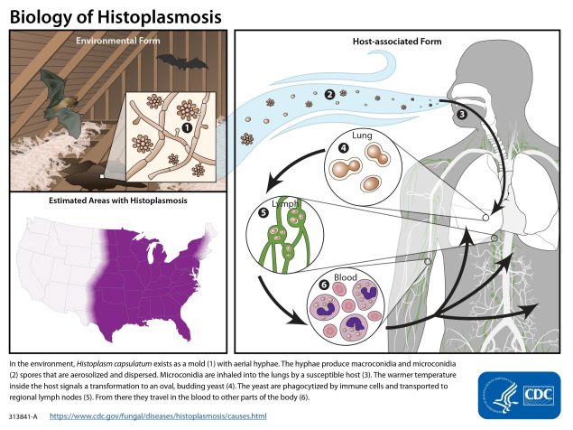 Illustration with text: In the environment, Histoplasma capsulatum exists as a mold with aerial hyphae. The hyphae produce macroconidia and microconidia spores that are aerosolized and dispersed. Microconidia are inhaled into the lungs by a susceptible host. The warmer temperature inside the host signals a transformation to an oval, budding yeast. The yeast are phagocytized by immune cells and transported to regional lymph nodes. From there they travel in the blood to other parts of the body.