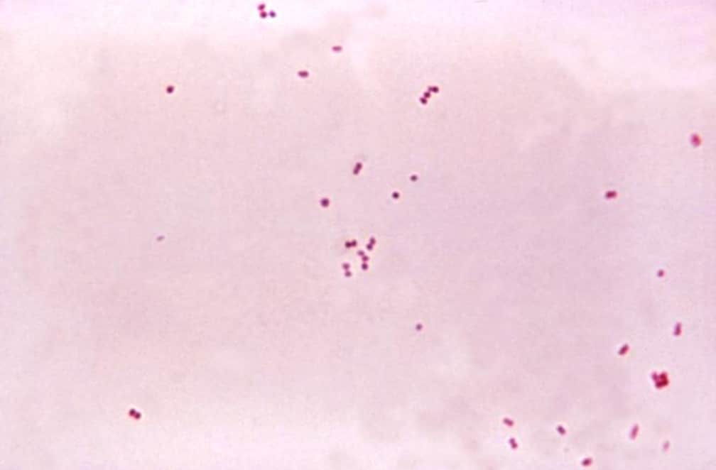 A microscopic view of Neisseria meningitidis bacteria, stained red. The bacteria are very small in the image and have a two-sphered shape.