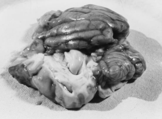 Black-and-white photo of a dissected dog brain displaying inflammation and swelling, two hallmarks of meningitis. Blood vessels and ridges on the brain are visible.”