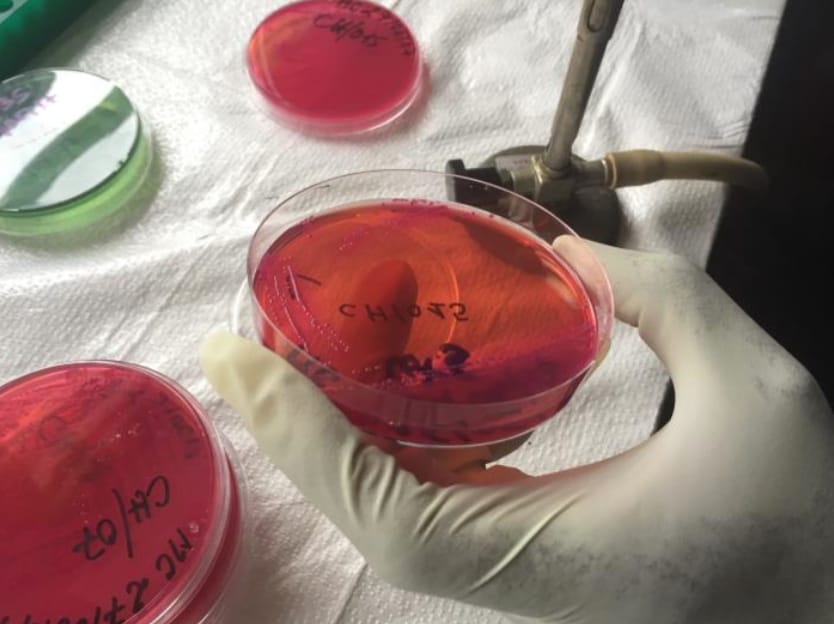 Image containing four biological samples (three red, one green) being analyzed for infectious agents like ebolavirus, Vibrio cholerae, and Neisseria meningitidis. The samples are all found in Petri dishes. A gloved hand is shown holding one of the red samples above a sheet of white cloth.