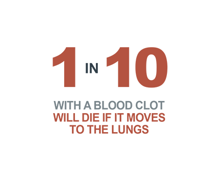 1 in 10 with a blood clot will die if it moves to the lungs