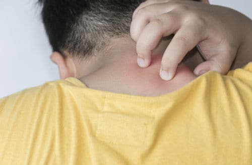 Photo of boy scratching back of neck