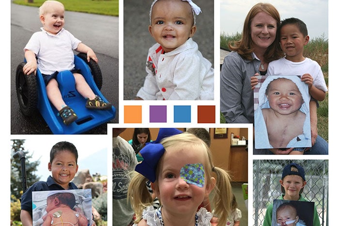Photo collage of a diverse group of people living with a birth defect