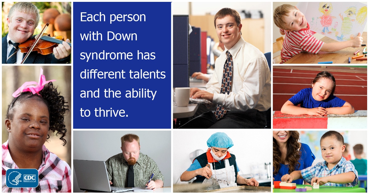 Each person with Down syndrome has different talents and the ability to thrive.