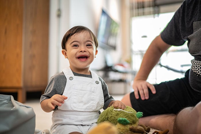 6 things to expect with Down syndrome babies, Pediatrics