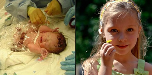 Ashley as an infant in the hospital and at her current age.