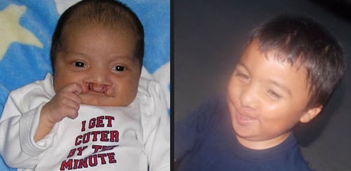 Joshua as an infant and young child