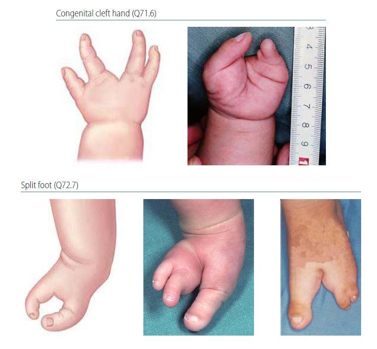 Fig. 4.41. Split hand and foot
