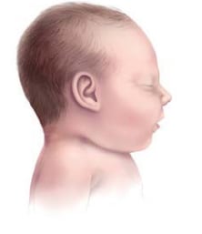 figure of Normal infant ear