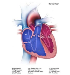 Fig. 4.20. Hypoplastic left heart syndrome