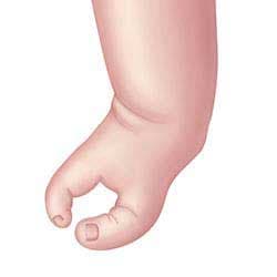 Split foot illustration