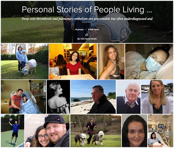 Flikr Album: Personal Stories of People Living with DVT