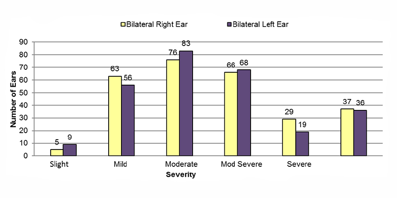 Among bilateral conductive cases, in the right ear, 5 had slight, 63 had mild, 76 had moderate, 66 had moderately severe, 29 had severe and 37 had an unknown severity of hearing loss. In the left ear, 9 had slight, 56 had mild, 83 had moderate, 68 had moderately severe, 19 had severe and 36 had an unknown severity of hearing loss.