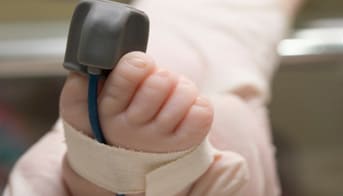Pulse oximeter on baby's toe