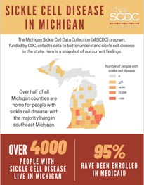SCD in Michigan - data graphic image thumbnail