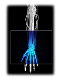 x ray of human arm