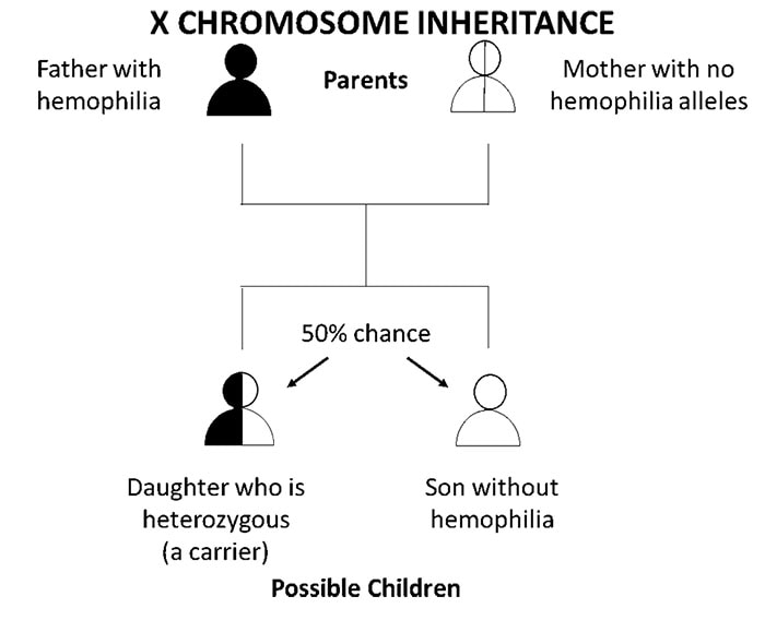 Flow chart showing fragile x inheritance where father has hemophilia and mother does not have hemophilia alleles