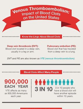 Infographic: VTE - Impact of Blood Clots on the United States