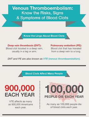 Infographic: VTE - Know the Risks, Signs & Symptoms of Blood Clots