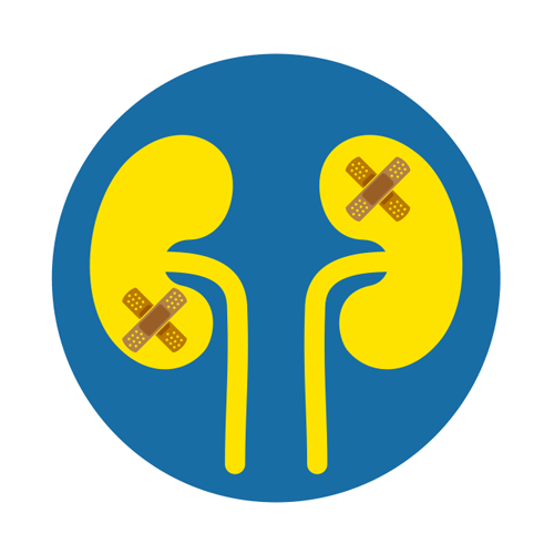 Illustration showing kidneys with damage