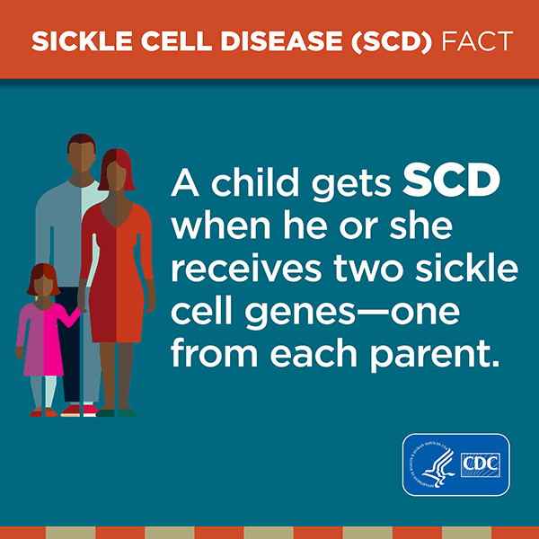 Sickle Cell Disease (SCD) Fact. A child gets SCD when he or she receives two sickle cell genes â€“ one from each parent. 