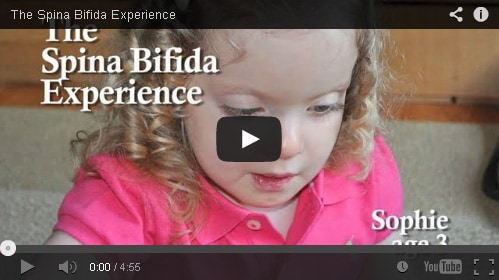 Image of Spina Bifida Video