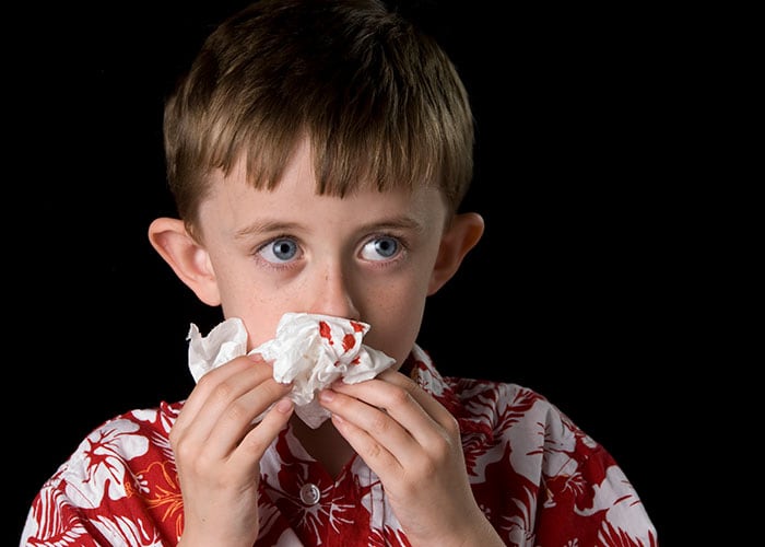 A child with a nose bleed