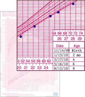 Cdc Growth Chart Infant Girl