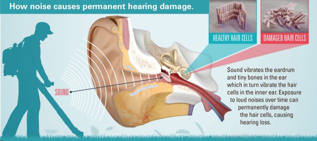 How noise causes permanently hearing damage