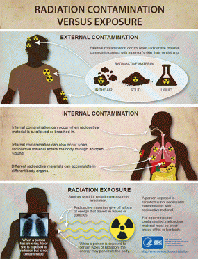 Radiation Contamination Versus Exposure