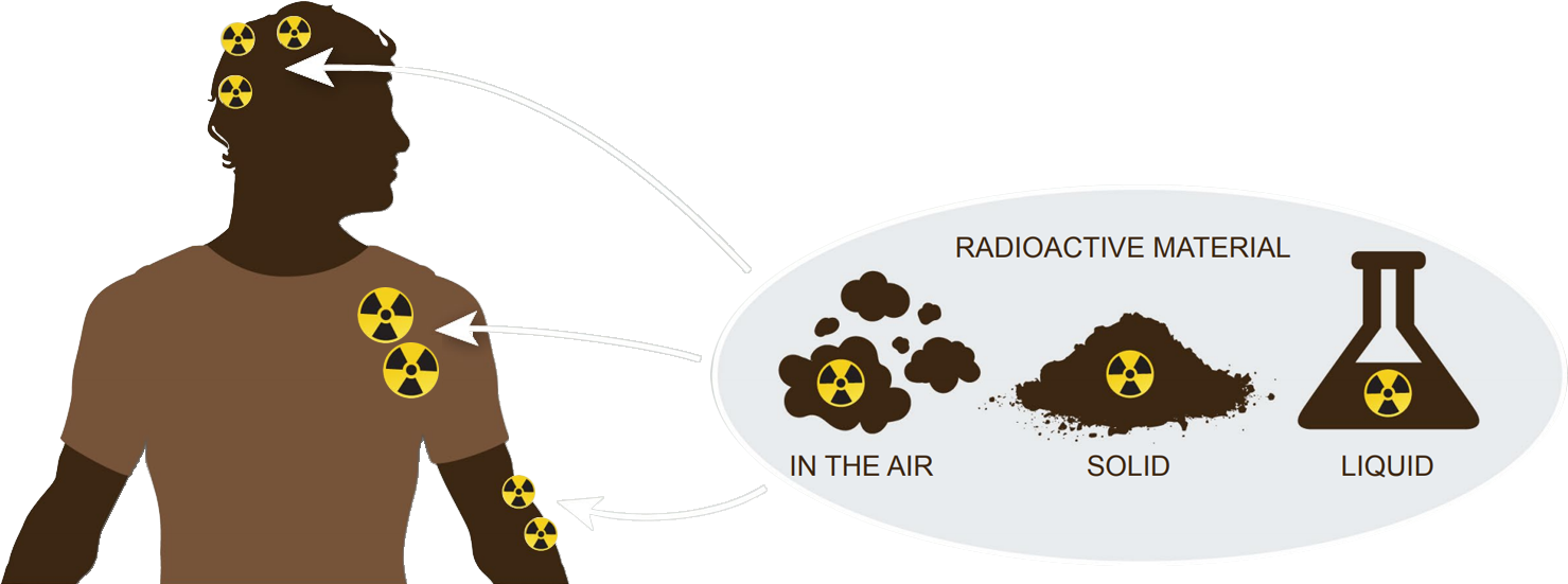 vector graphic showing external radiation contamination through the contact with radioactive material in the air, solid or liquid radioactive material.