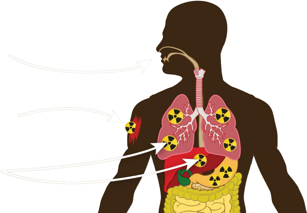vector graphic showing internal radiation contamination from swallowing or breathing in radioactive material.