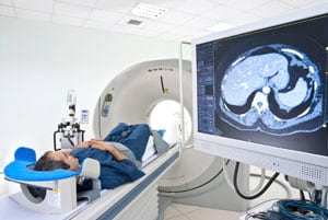 Image of man receiving Computed Tomography (CT) scan