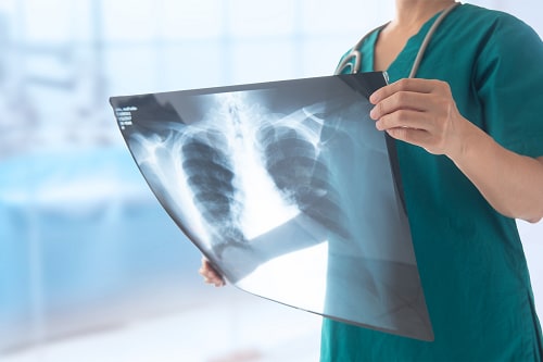 Radiology doctor looking at patient x-ray 