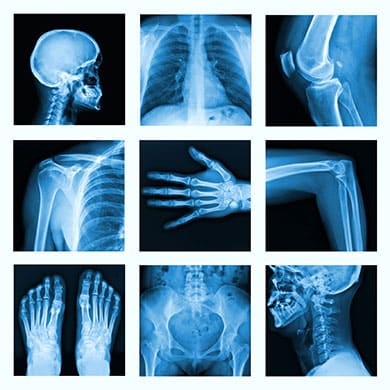 Radiation in Healthcare: X-Rays | Radiation | NCEH | CDC