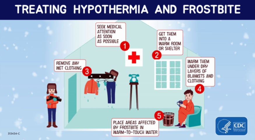 Treating hypothermia and frostbite