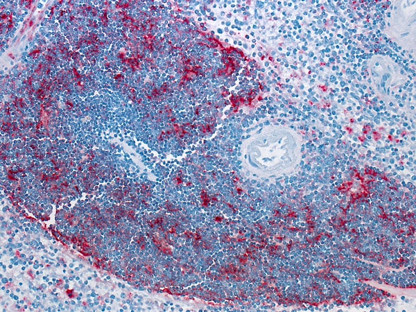 A pathogen with blue, purple and magenta hues. 