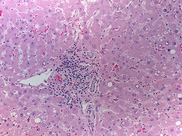 A pathogen with mostly light magenta hue with notable navy dots.