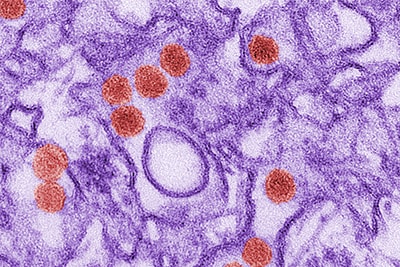 A digitally colorized transmission electron microscopic (TEM) image of Zika virus