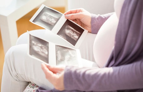 Woman looking at pictures of sonogram