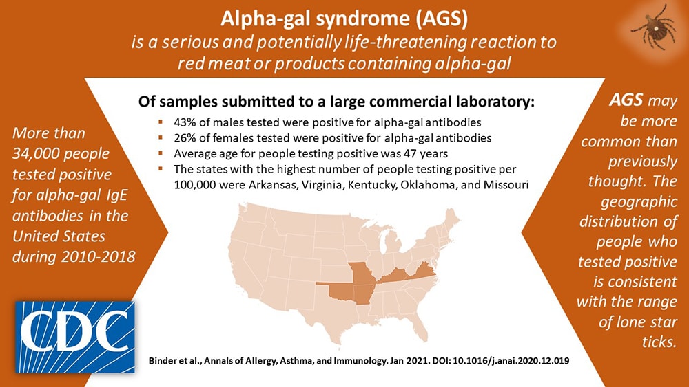 Alpha-gal syndrome (AGS) is a serious and potentially life-threatening reaction to read meat or products containing alpha-gal