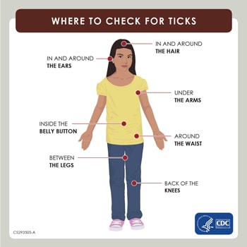 Illustration of places to check for ticks, including ears, hair, arms, belly button, waist, legs, and knees